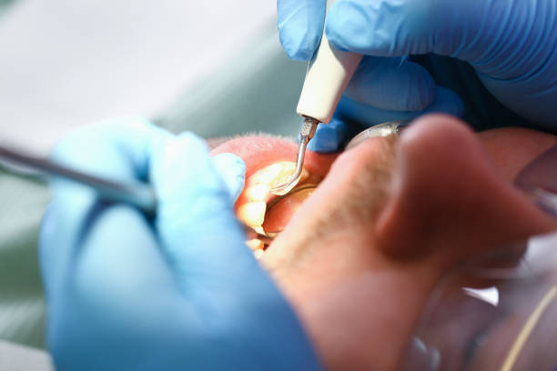 Best Broken Tooth Emergency  in El Verano, CA